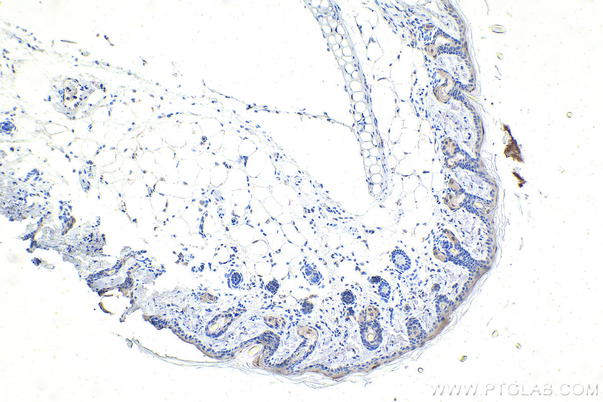 Immunohistochemistry (IHC) staining of rat skin tissue using DDX1 Monoclonal antibody (67991-1-Ig)