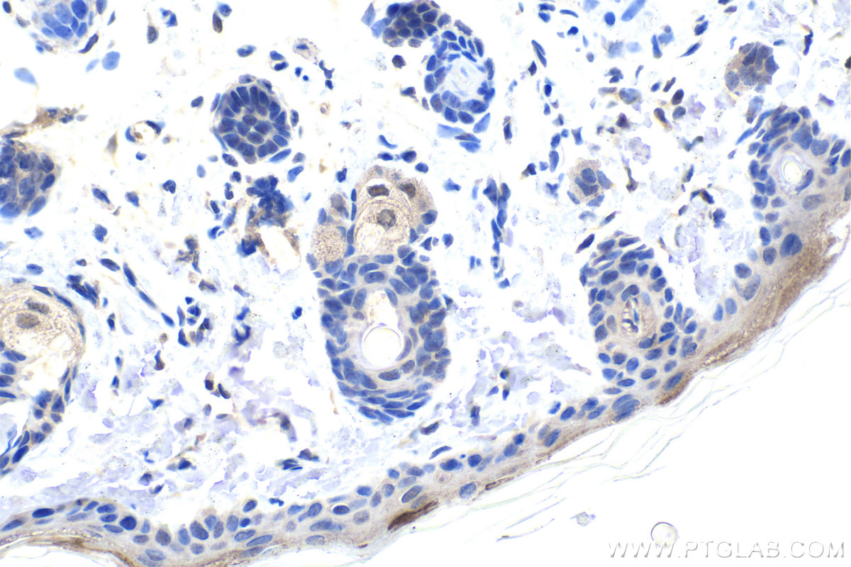 Immunohistochemistry (IHC) staining of rat skin tissue using DDX1 Monoclonal antibody (67991-1-Ig)