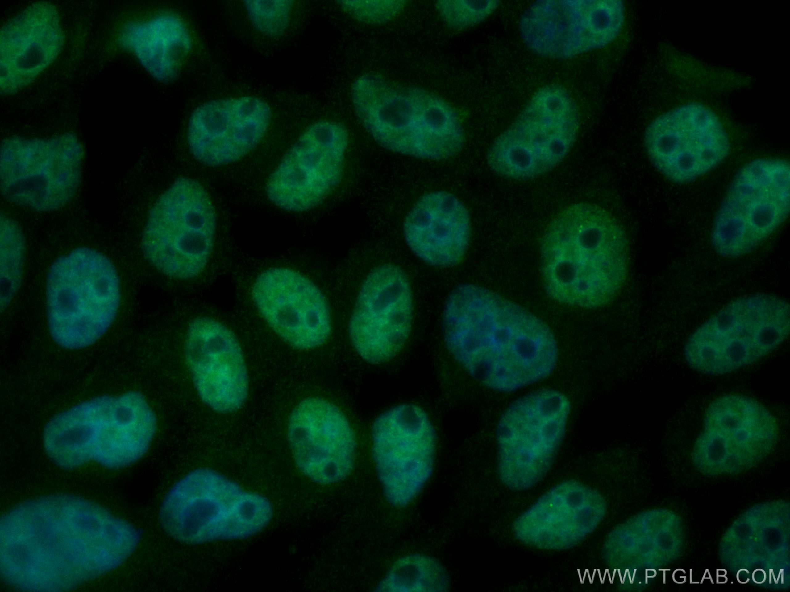 Immunofluorescence (IF) / fluorescent staining of A431 cells using CoraLite® Plus 488-conjugated DDX1 Monoclonal anti (CL488-67991)