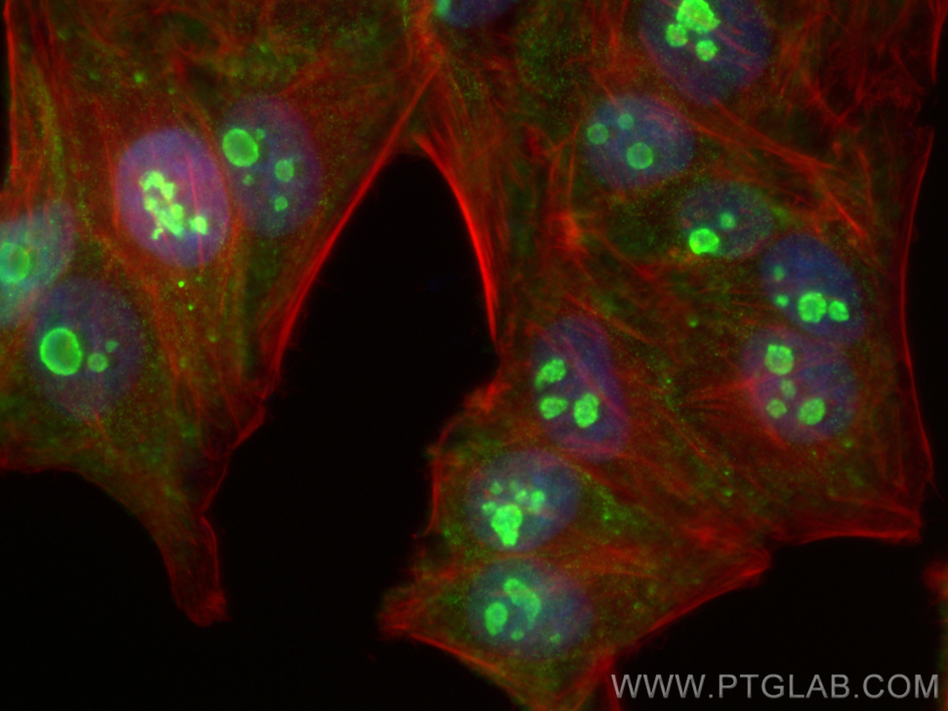 Immunofluorescence (IF) / fluorescent staining of HepG2 cells using DDX21 Monoclonal antibody (66925-1-Ig)