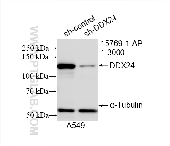 Western Blot (WB) analysis of A549 cells using DDX24 Polyclonal antibody (15769-1-AP)