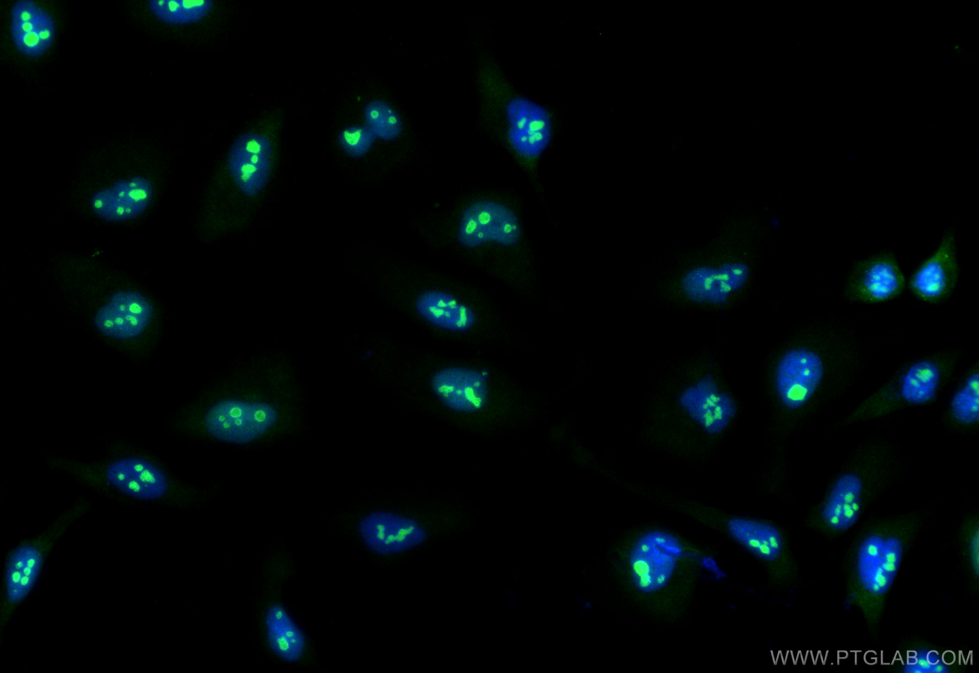 Immunofluorescence (IF) / fluorescent staining of HeLa cells using DDX24 Recombinant antibody (84103-6-RR)