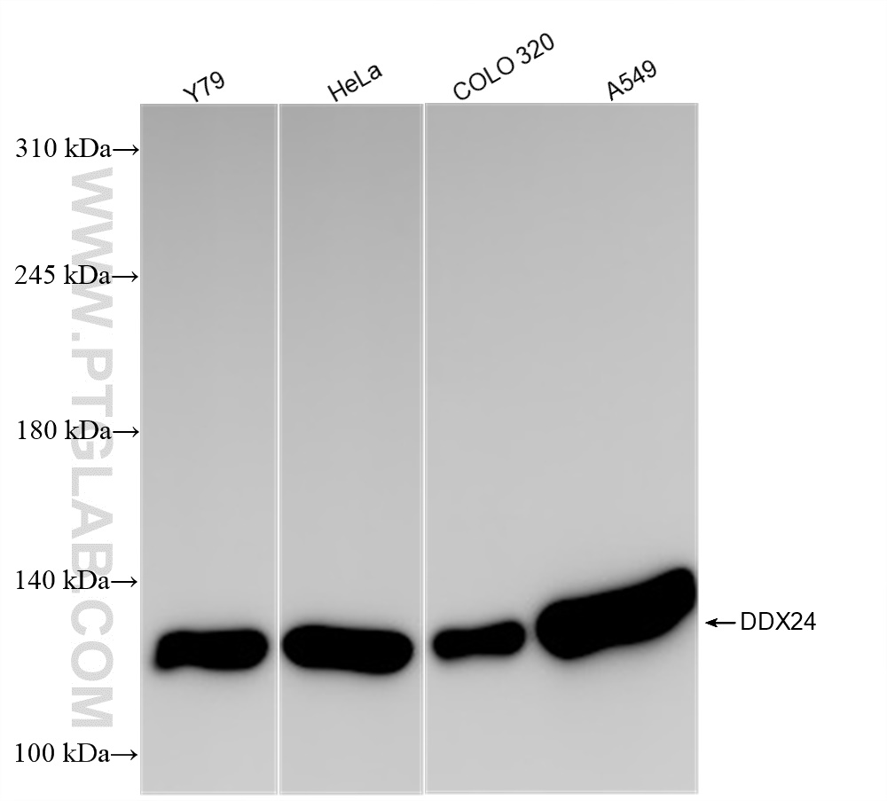 Western Blot (WB) analysis of various lysates using DDX24 Recombinant antibody (84103-6-RR)