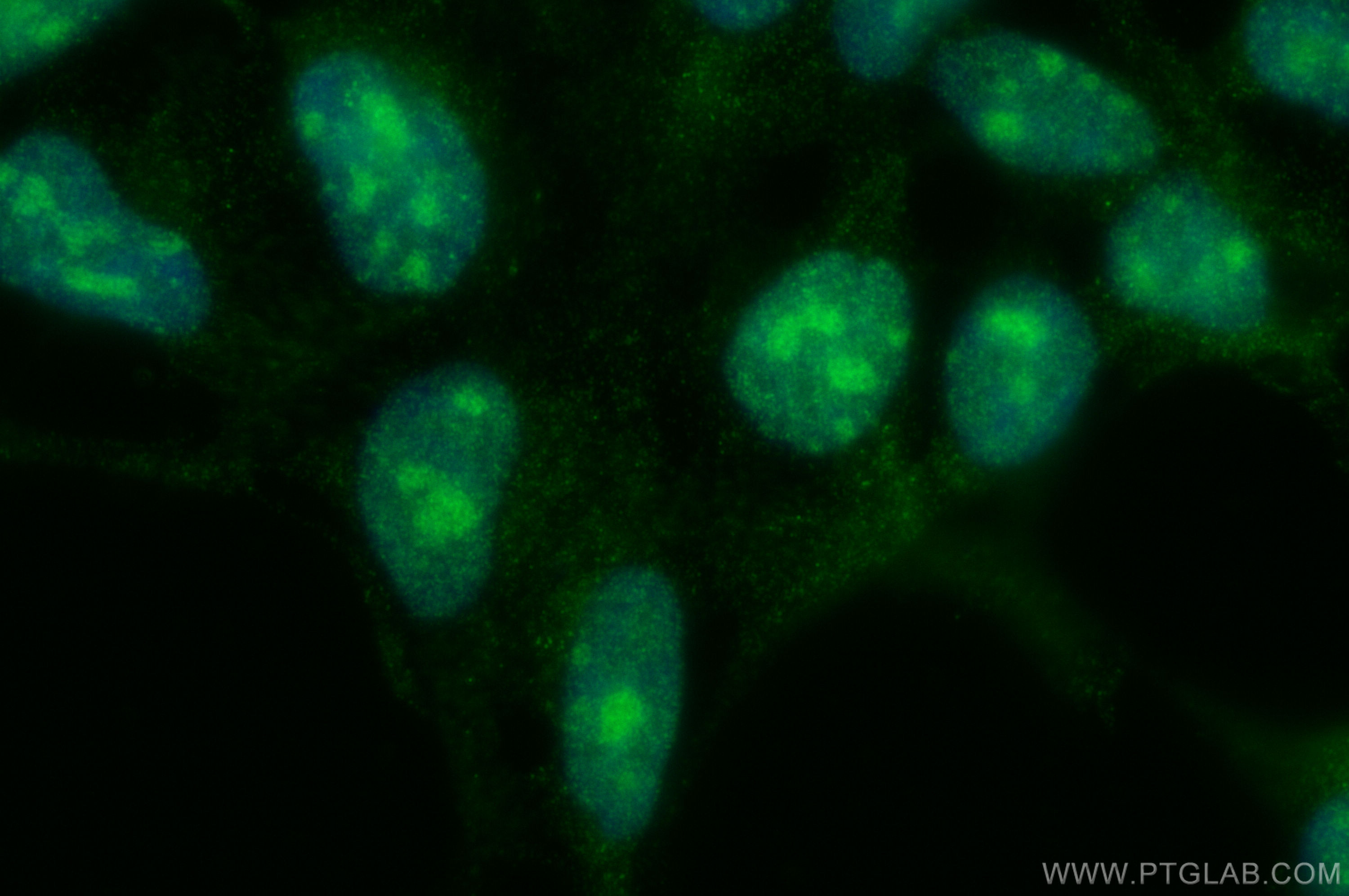 Immunofluorescence (IF) / fluorescent staining of HEK-293 cells using DDX27 Polyclonal antibody (17087-1-AP)