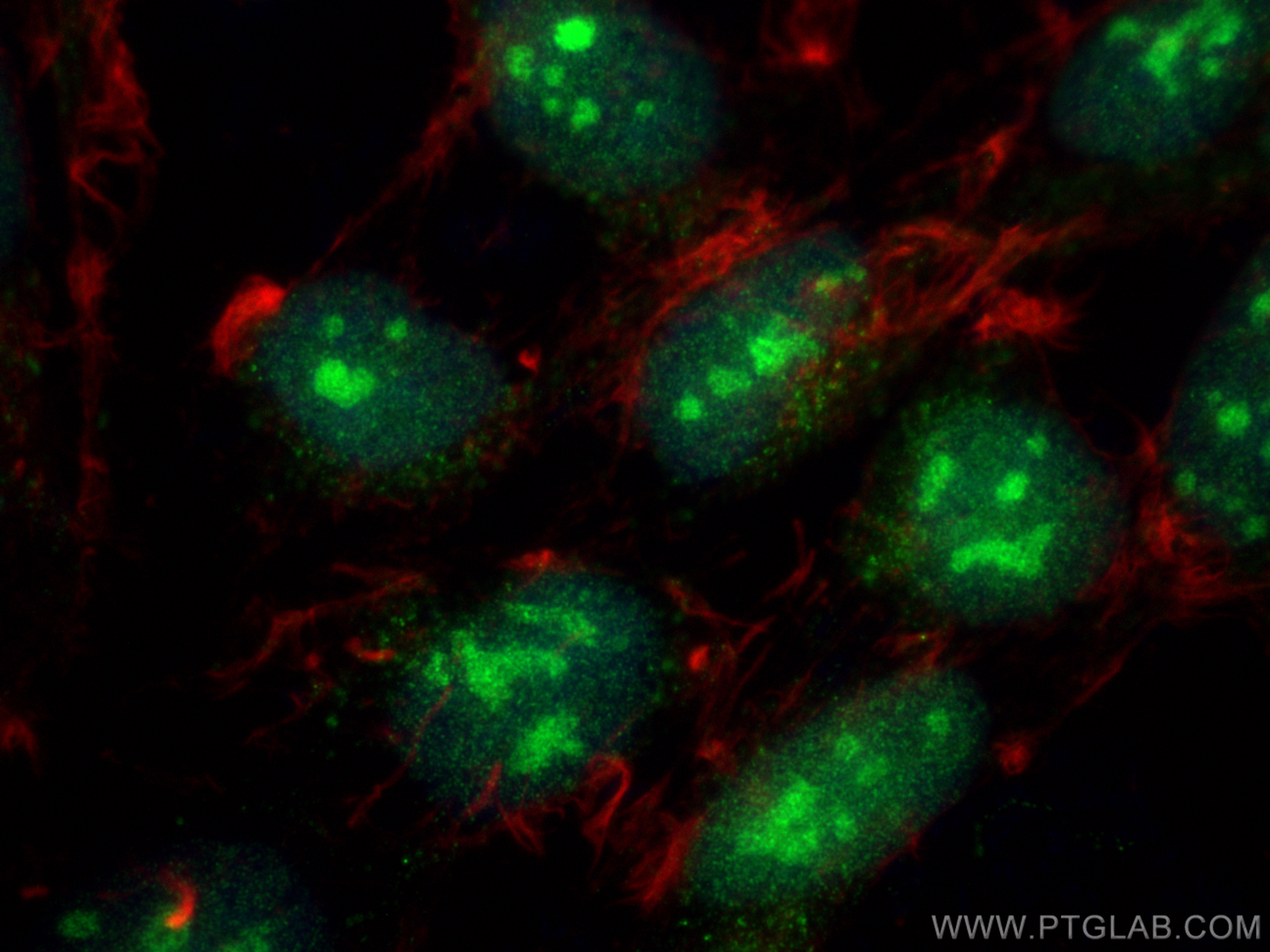 Immunofluorescence (IF) / fluorescent staining of HEK-293 cells using DDX27 Polyclonal antibody (17087-1-AP)