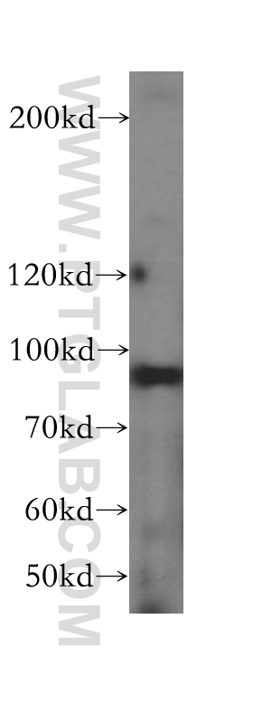 Western Blot (WB) analysis of HeLa cells using DDX27 Polyclonal antibody (17087-1-AP)