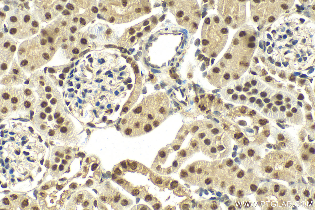 Immunohistochemistry (IHC) staining of mouse kidney tissue using DDX39A Recombinant antibody (83083-5-RR)