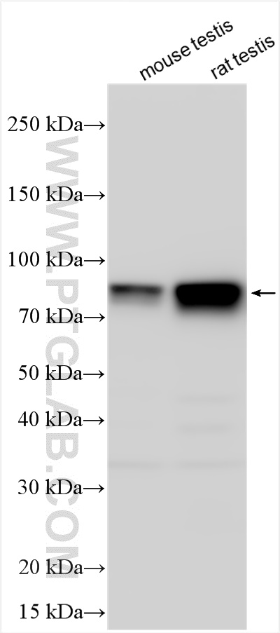 Western Blot (WB) analysis of various lysates using DDX4,VASA Polyclonal antibody (51042-1-AP)