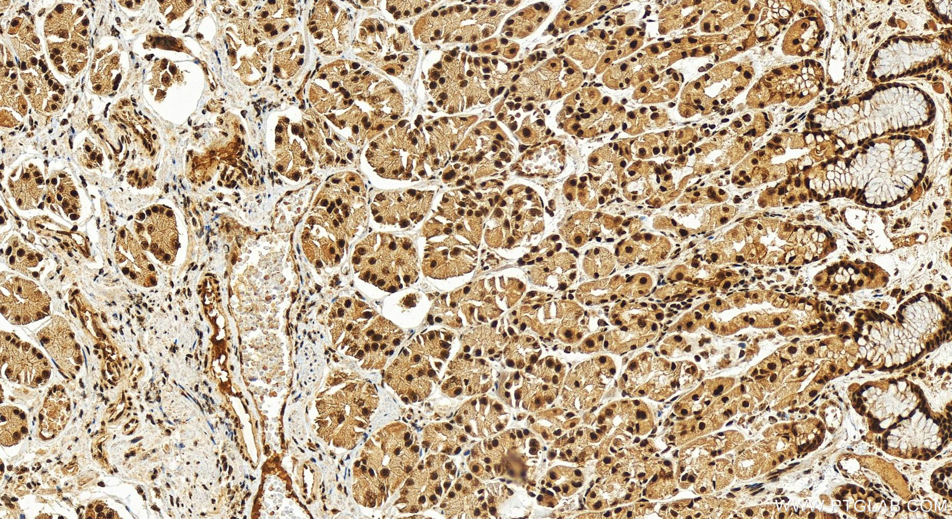 Immunohistochemistry (IHC) staining of human stomach tissue using DDX46 Polyclonal antibody (16927-1-AP)