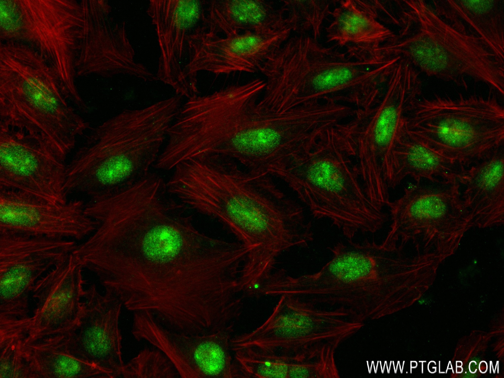 Immunofluorescence (IF) / fluorescent staining of U2OS cells using DDX47 Recombinant antibody (83287-3-RR)