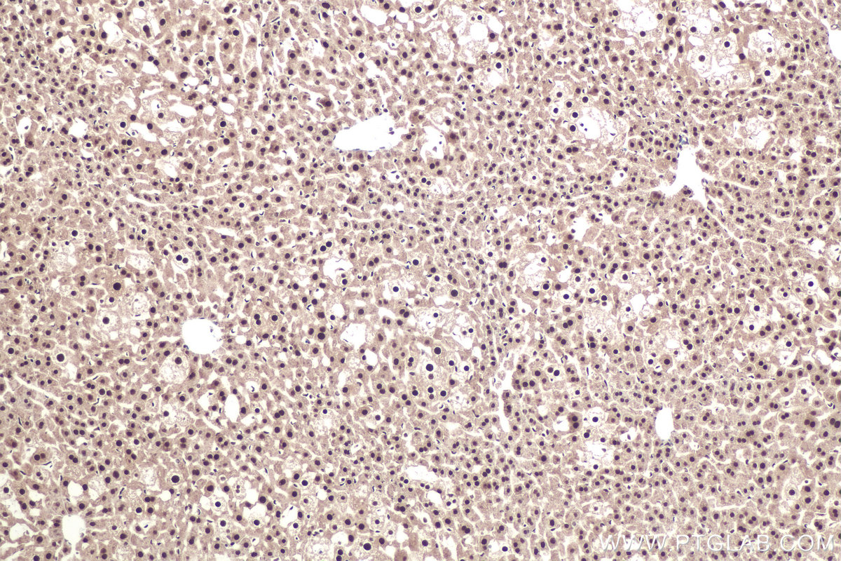 Immunohistochemistry (IHC) staining of mouse liver tissue using DDX5 Polyclonal antibody (26385-1-AP)