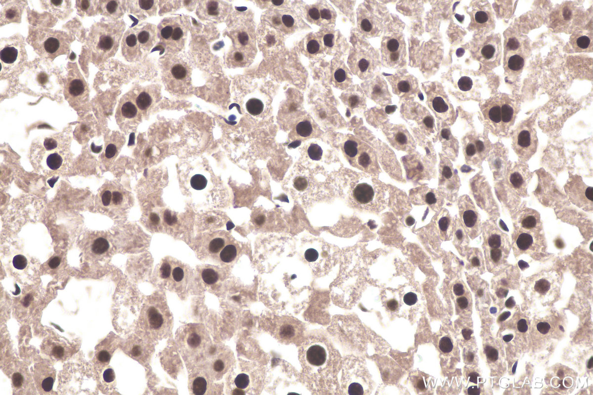 Immunohistochemistry (IHC) staining of mouse liver tissue using DDX5 Polyclonal antibody (26385-1-AP)