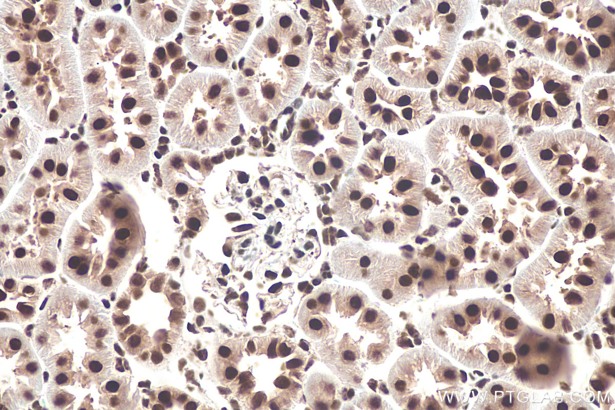 Immunohistochemistry (IHC) staining of rat kidney tissue using DDX5 Polyclonal antibody (26385-1-AP)