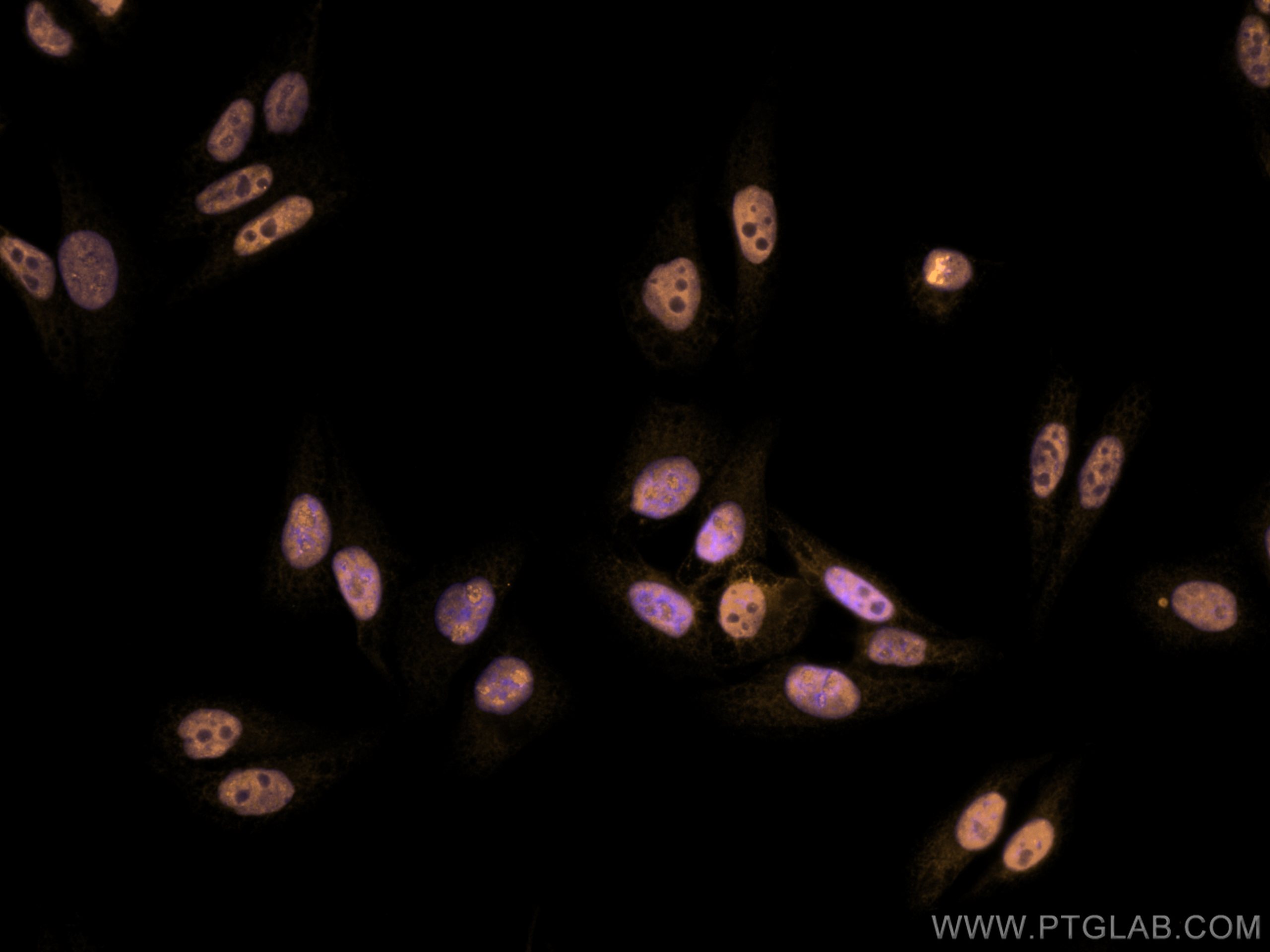 Immunofluorescence (IF) / fluorescent staining of HepG2 cells using CoraLite®555-conjugated DDX5 Monoclonal antibody (CL555-67025)