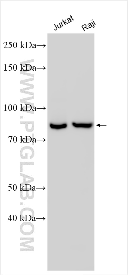 Western Blot (WB) analysis of various lysates using DDX51 Polyclonal antibody (20149-1-AP)