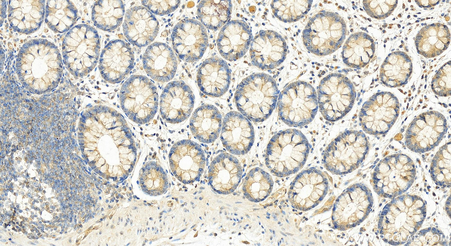 Immunohistochemistry (IHC) staining of human colon tissue using RIG-1/DDX58 Polyclonal antibody (25068-1-AP)