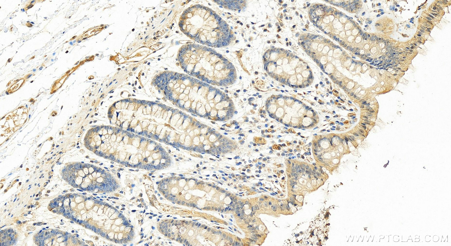 Immunohistochemistry (IHC) staining of human colon tissue using RIG-1/DDX58 Polyclonal antibody (25068-1-AP)