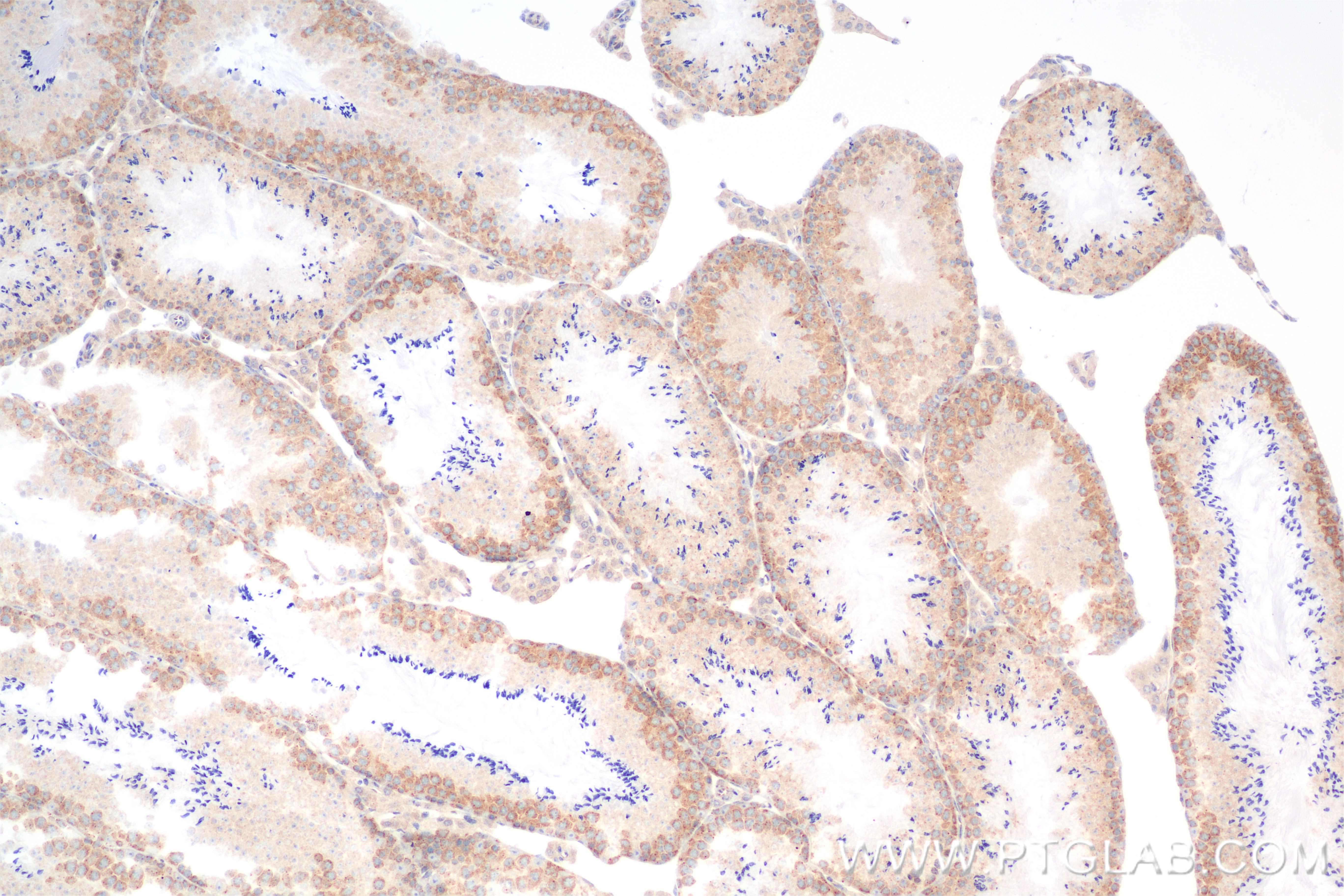 Immunohistochemistry (IHC) staining of mouse testis tissue using DDX6 Recombinant antibody (85686-1-RR)