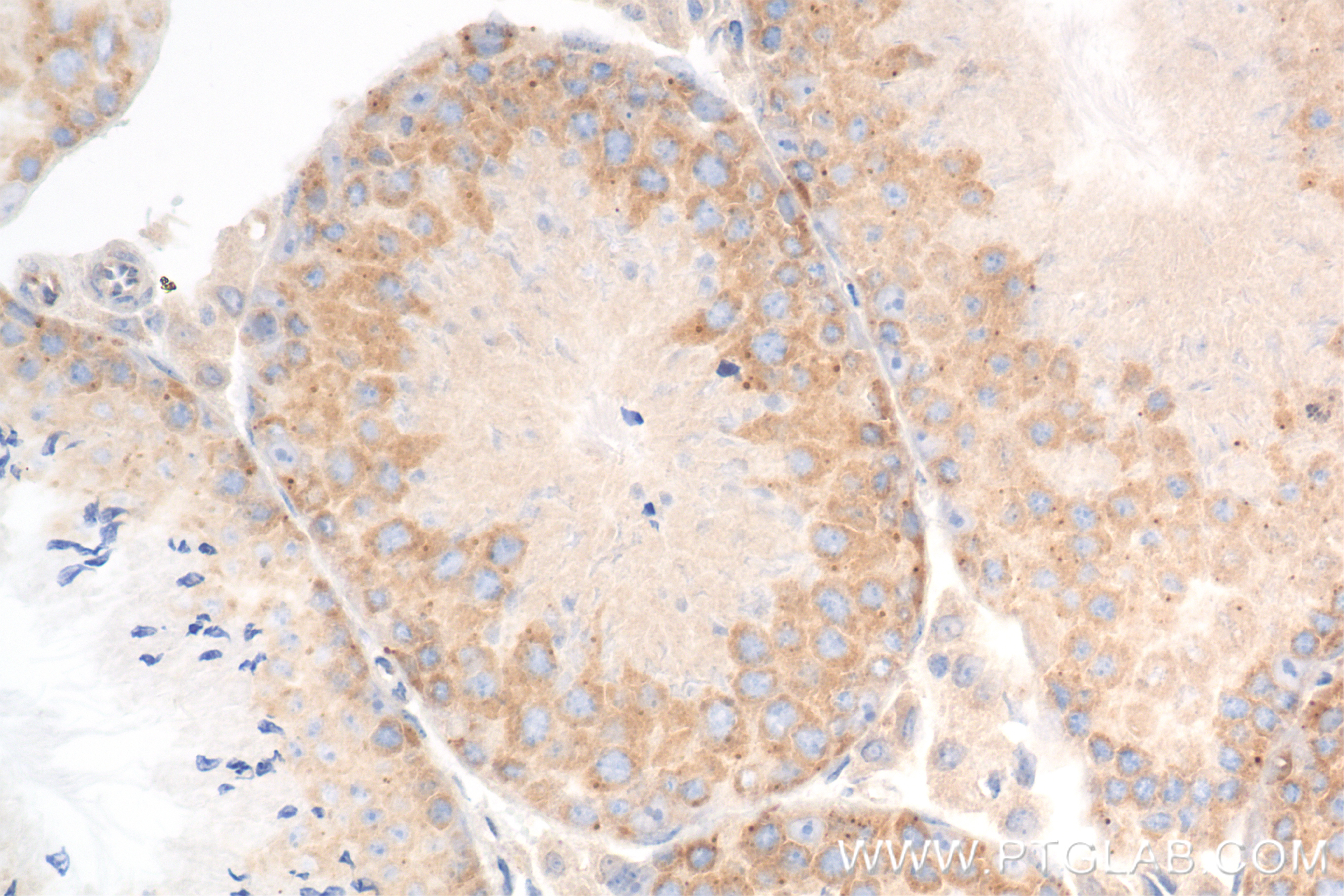 Immunohistochemistry (IHC) staining of mouse testis tissue using DDX6 Recombinant antibody (85686-1-RR)