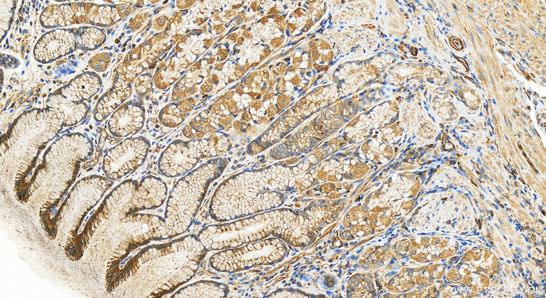 Immunohistochemistry (IHC) staining of human stomach tissue using DDX60 Polyclonal antibody (30982-1-AP)