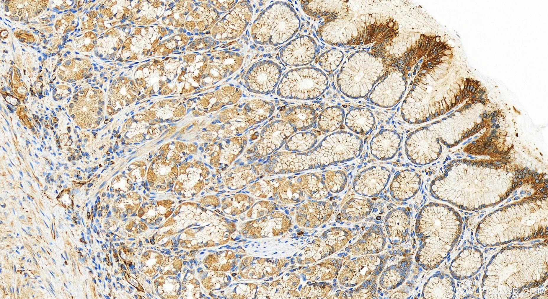 Immunohistochemistry (IHC) staining of human stomach tissue using DDX60 Polyclonal antibody (30982-1-AP)