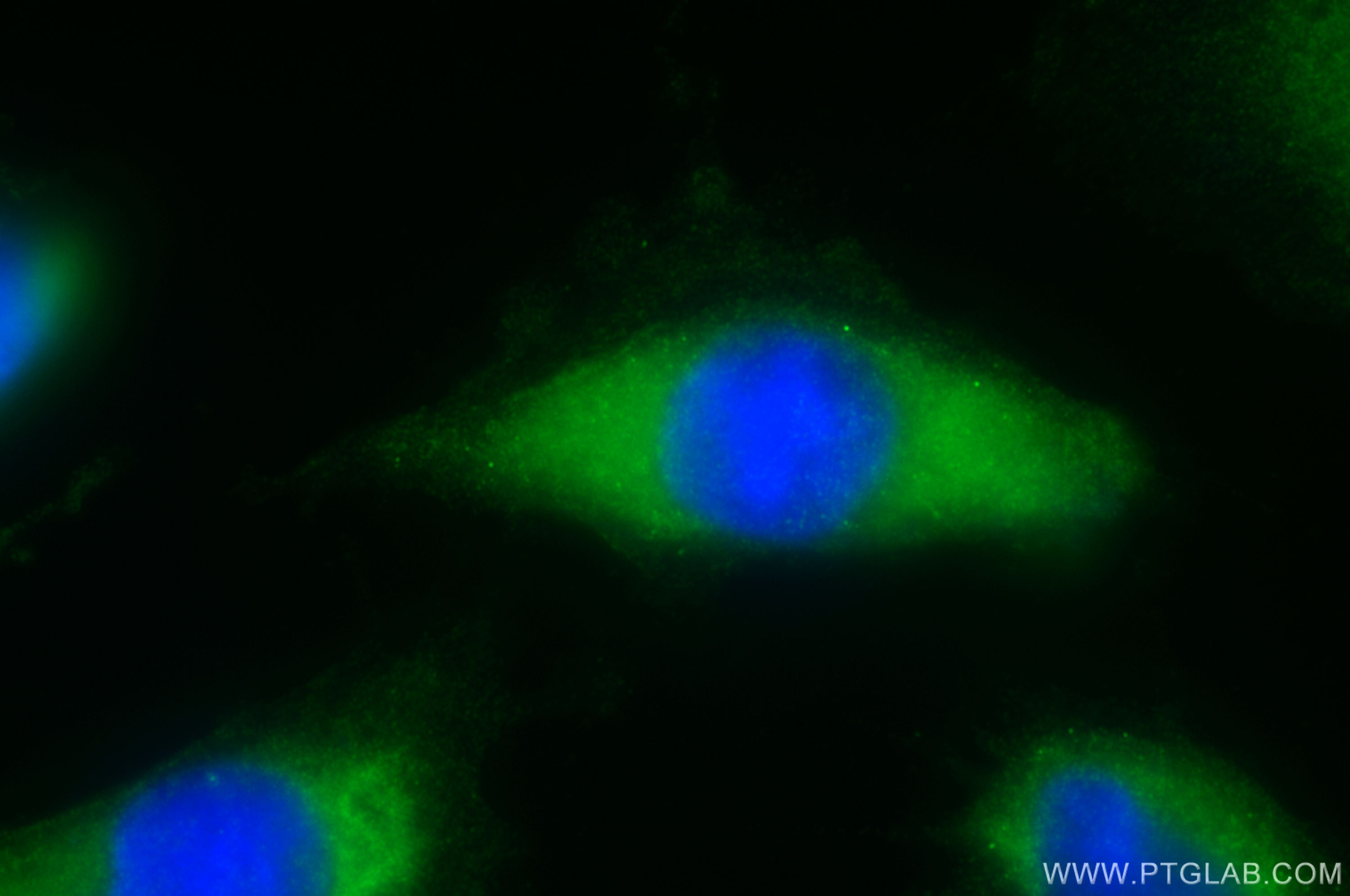 Immunofluorescence (IF) / fluorescent staining of U-251 cells using DDX60 Polyclonal antibody (30982-1-AP)