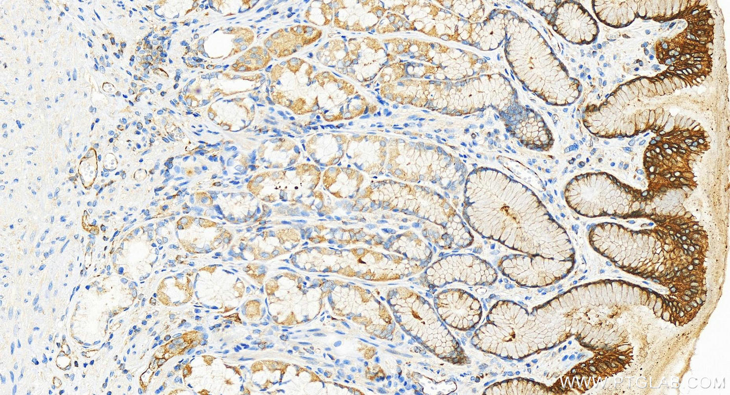 Immunohistochemistry (IHC) staining of human stomach tissue using DDX60 Recombinant antibody (82969-1-RR)