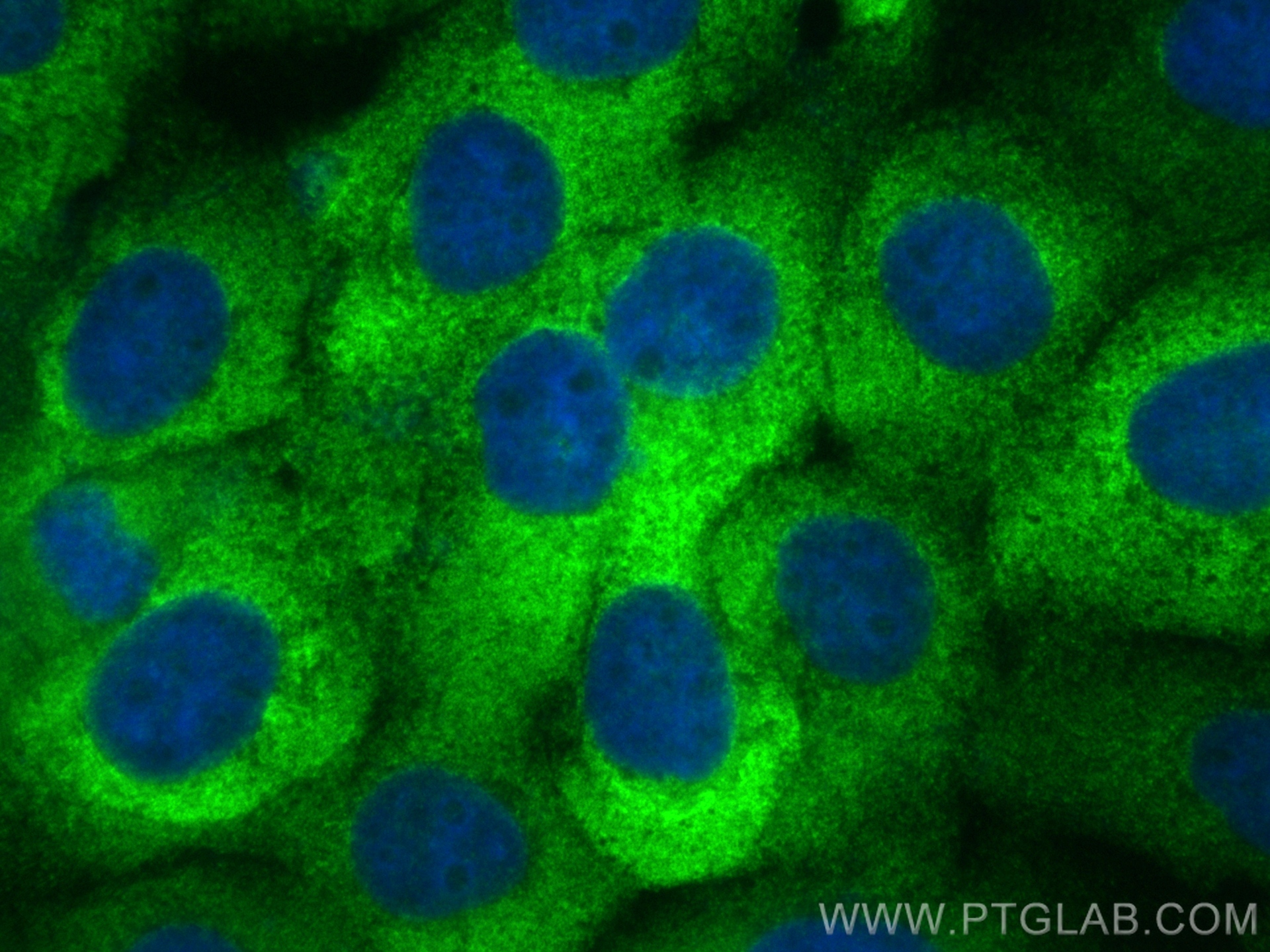 Immunofluorescence (IF) / fluorescent staining of A431 cells using DDX60 Recombinant antibody (82969-1-RR)