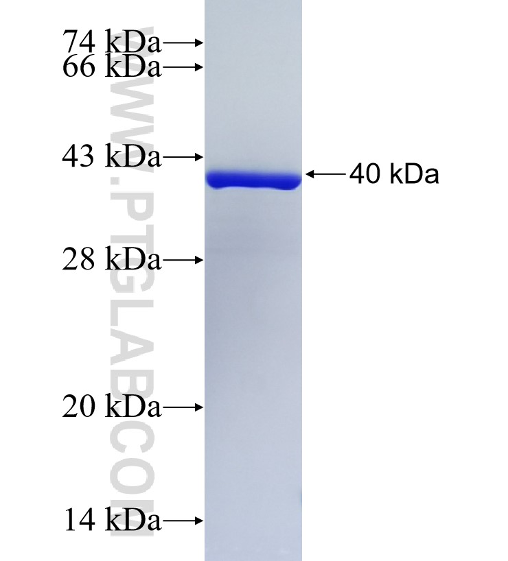 DDX60 fusion protein Ag34626 SDS-PAGE