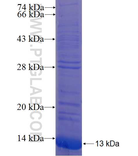 DEFB121 fusion protein Ag22789 SDS-PAGE