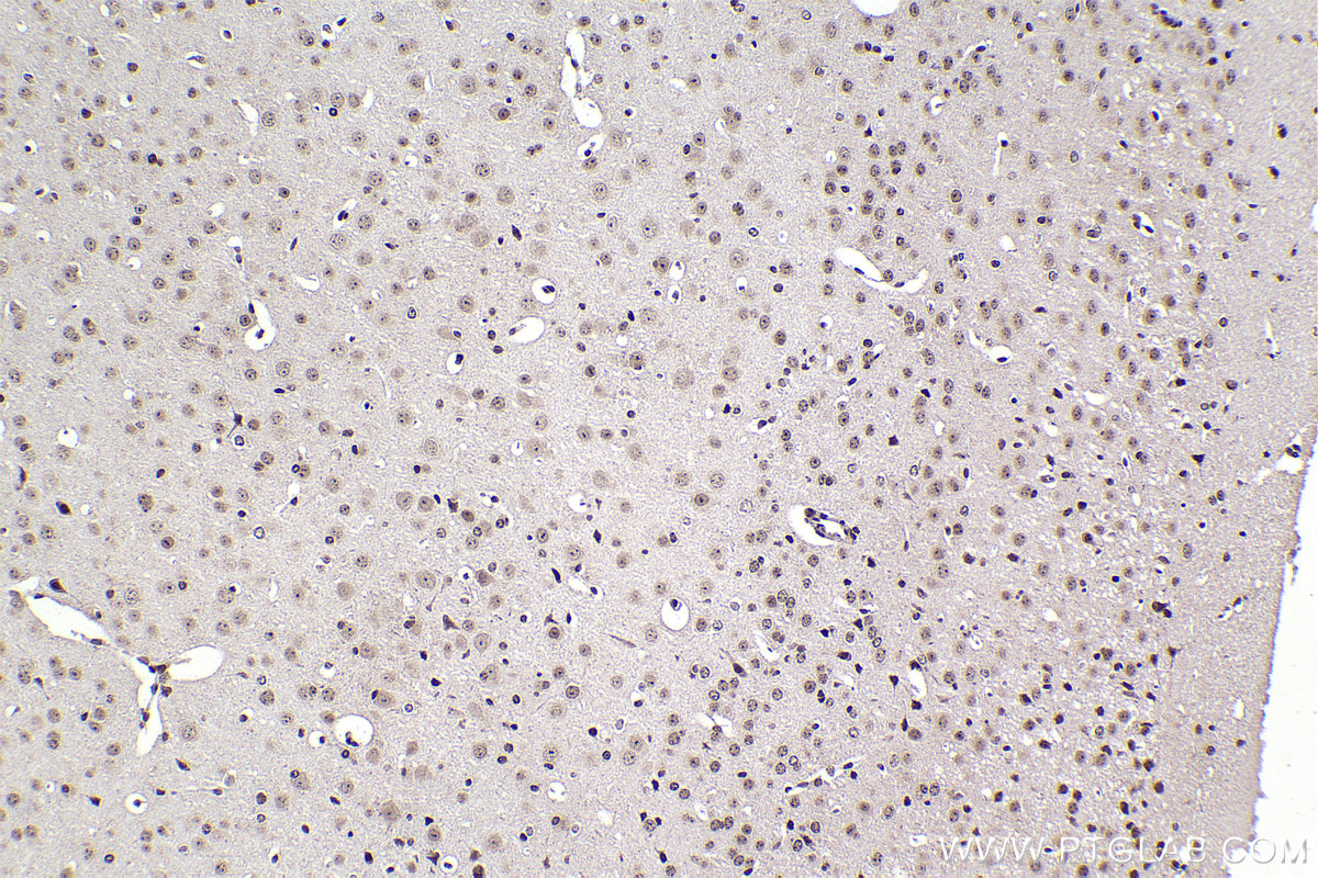 Immunohistochemistry (IHC) staining of mouse brain tissue using DEK Polyclonal antibody (16448-1-AP)