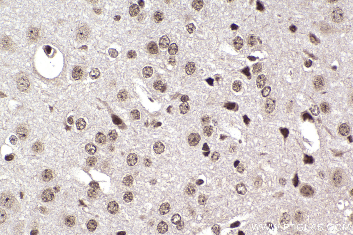 Immunohistochemistry (IHC) staining of mouse brain tissue using DEK Polyclonal antibody (16448-1-AP)