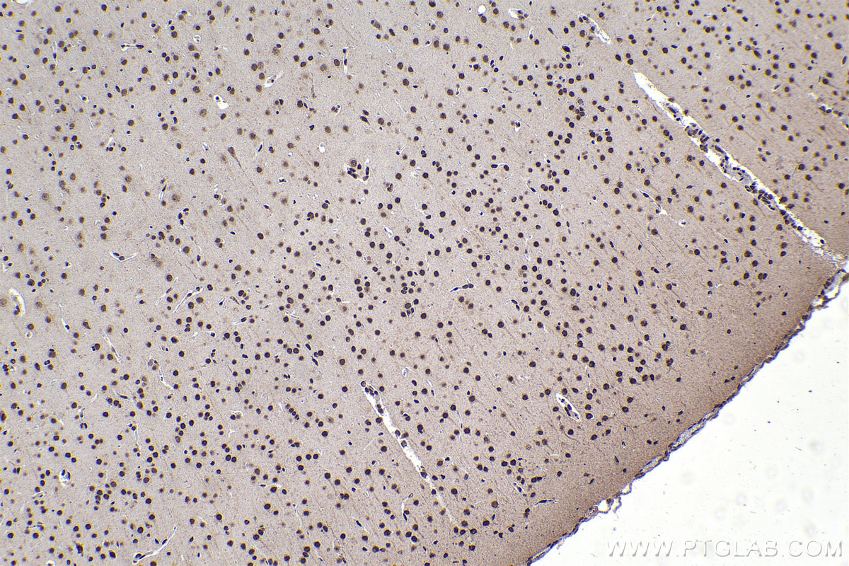 Immunohistochemistry (IHC) staining of rat brain tissue using DEK Polyclonal antibody (16448-1-AP)