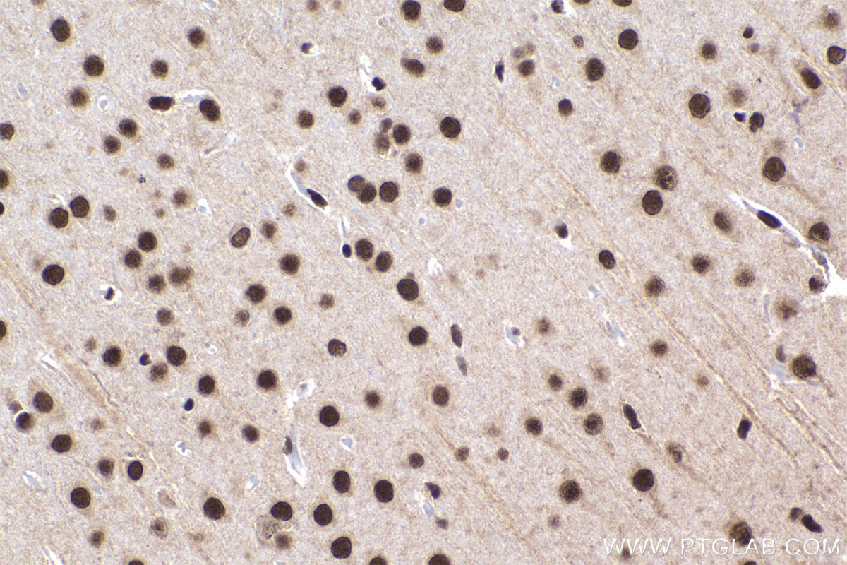 Immunohistochemistry (IHC) staining of rat brain tissue using DEK Polyclonal antibody (16448-1-AP)