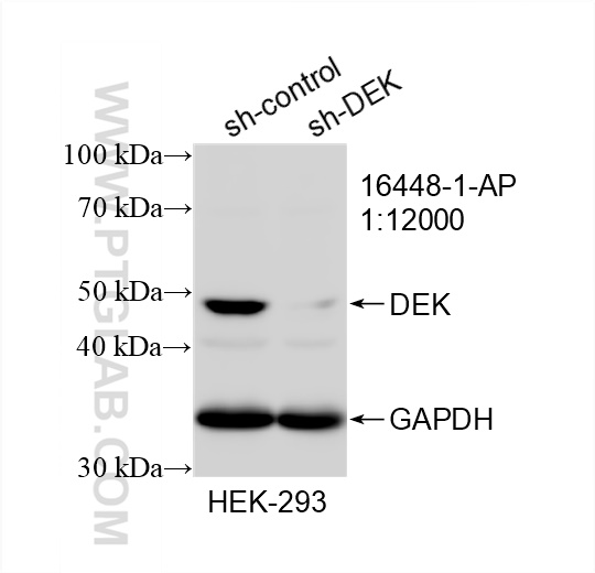 Western Blot (WB) analysis of HEK-293 cells using DEK Polyclonal antibody (16448-1-AP)