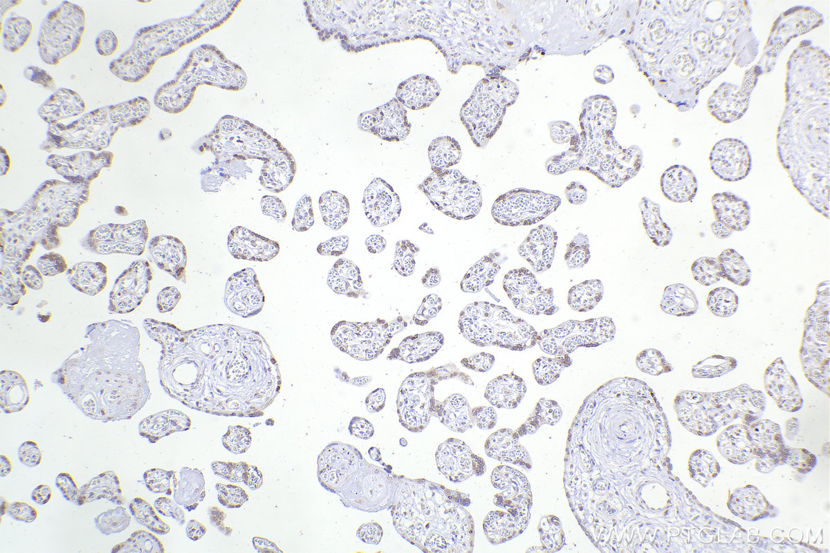 Immunohistochemistry (IHC) staining of human placenta tissue using DEK Monoclonal antibody (66194-1-Ig)