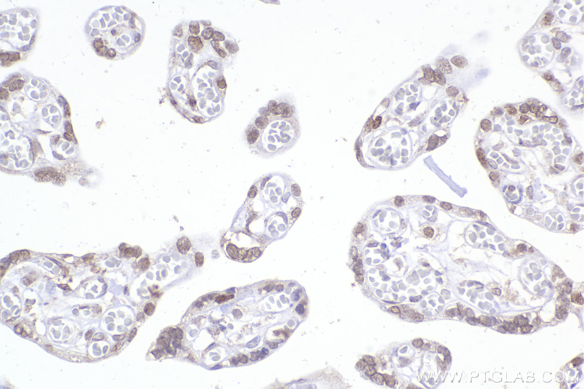 Immunohistochemistry (IHC) staining of human placenta tissue using DEK Monoclonal antibody (66194-1-Ig)