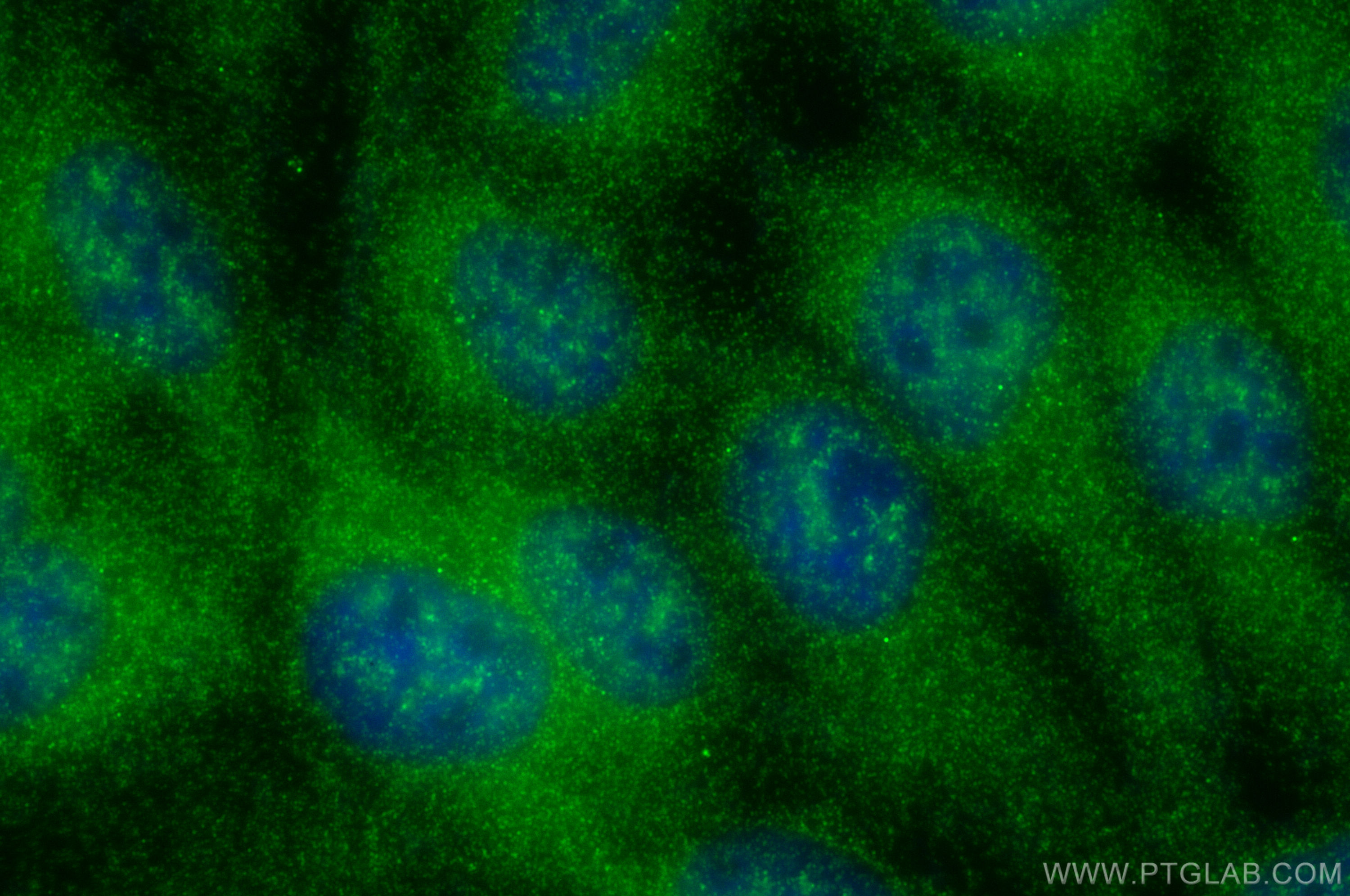 Immunofluorescence (IF) / fluorescent staining of A431 cells using DEM1/EXO5 Polyclonal antibody (25991-1-AP)