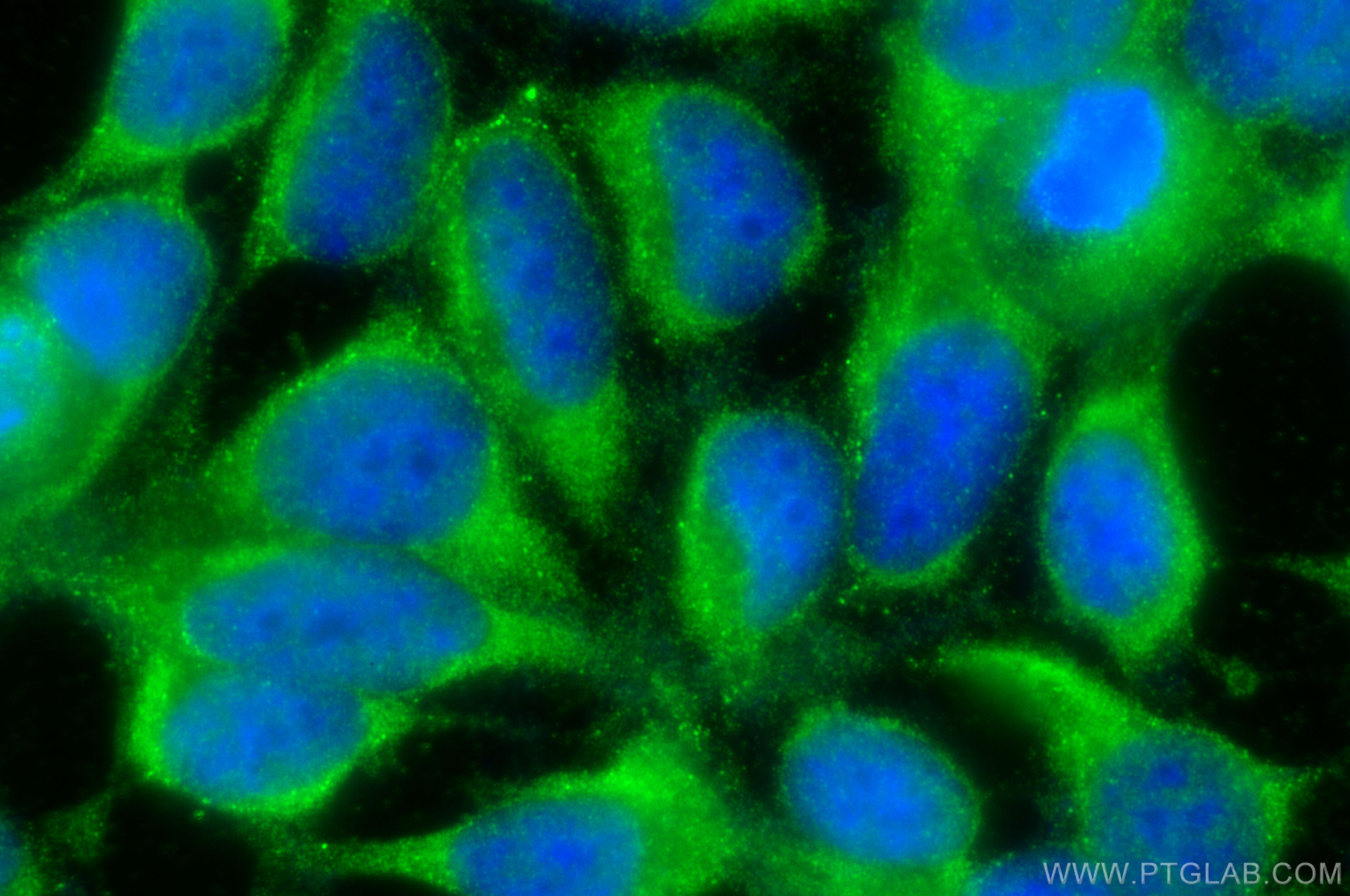 Immunofluorescence (IF) / fluorescent staining of HEK-293 cells using DENR Polyclonal antibody (10656-1-AP)