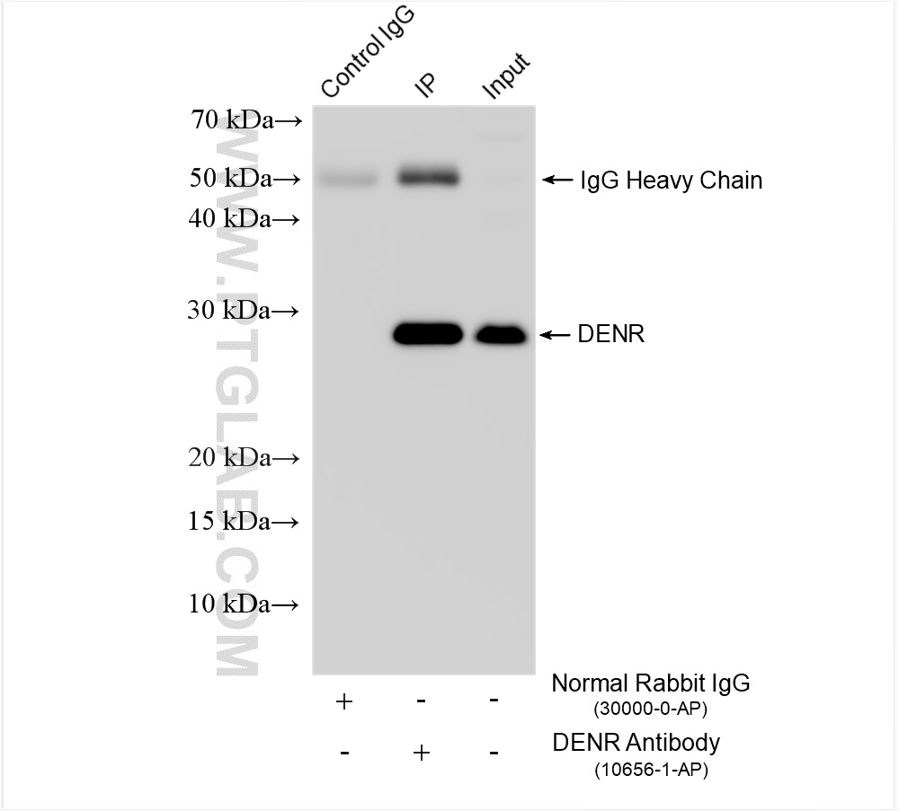 Immunoprecipitation (IP) experiment of HeLa cells using DENR Polyclonal antibody (10656-1-AP)