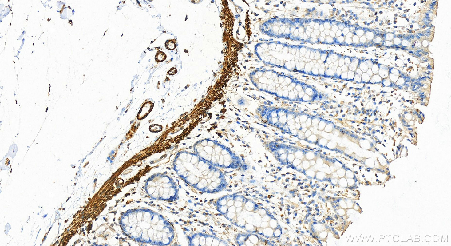 Immunohistochemistry (IHC) staining of human colon tissue using Desmin Polyclonal antibody (16520-1-AP)