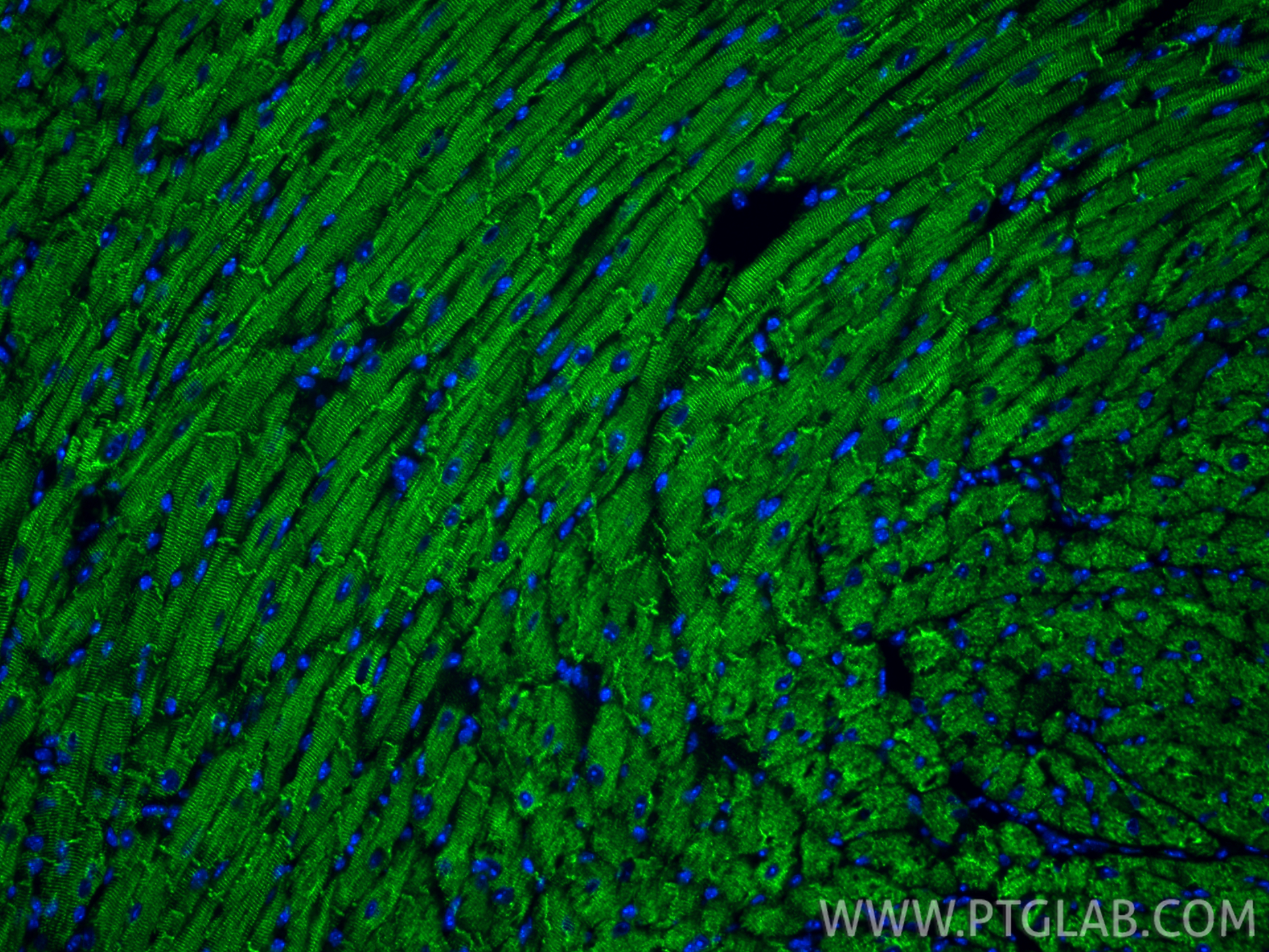 Immunofluorescence (IF) / fluorescent staining of mouse heart tissue using Desmin Polyclonal antibody (16520-1-AP)