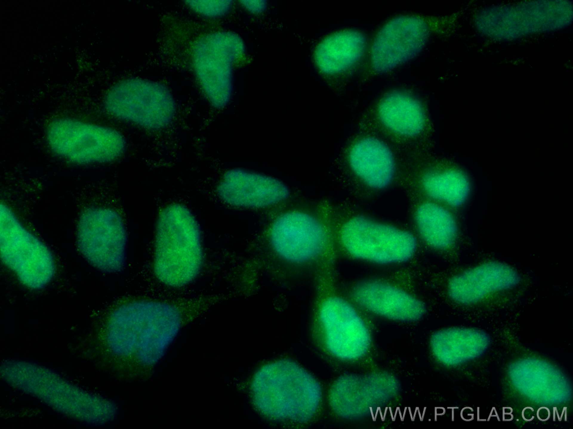 Immunofluorescence (IF) / fluorescent staining of HEK-293 cells using DFFA,DFF45 Monoclonal antibody (68177-1-Ig)