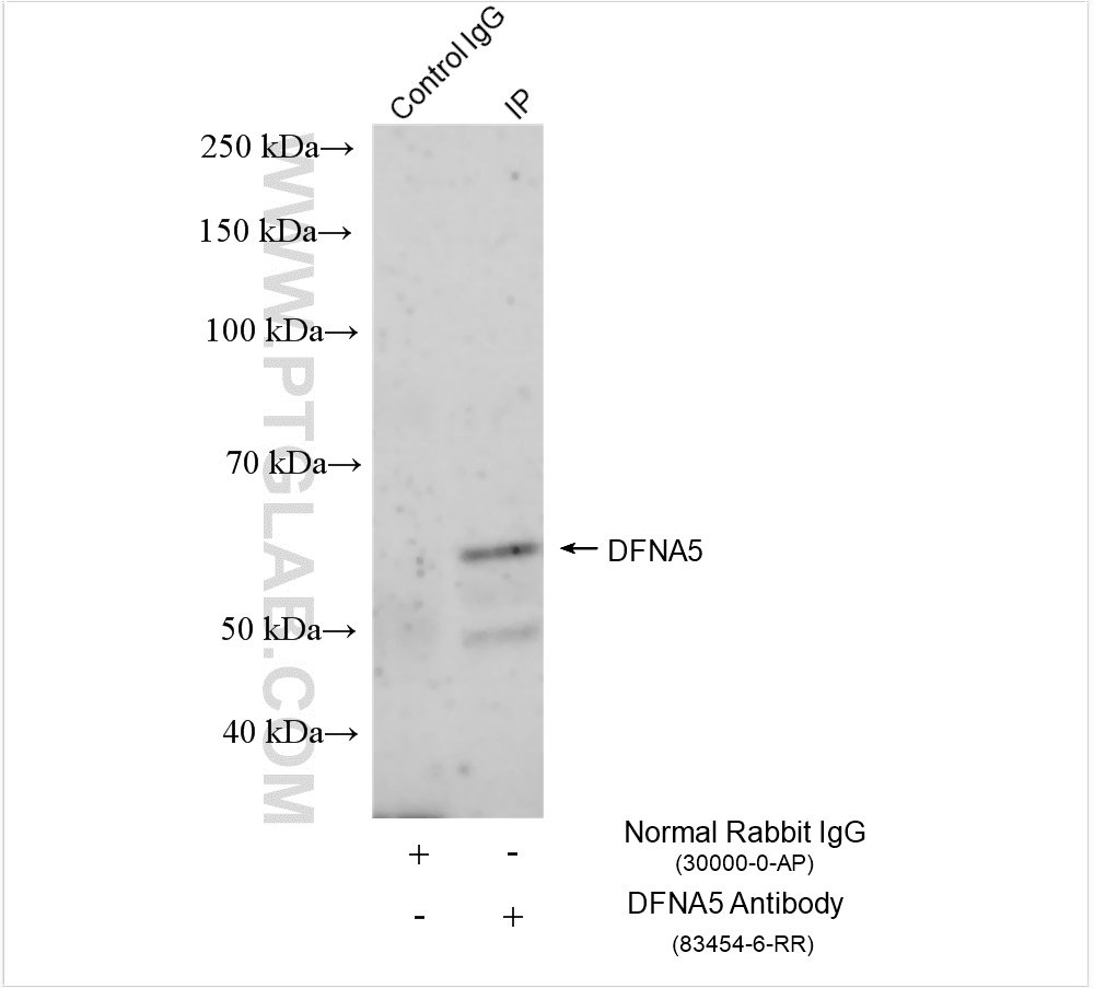 Immunoprecipitation (IP) experiment of SH-SY5Y cells using DFNA5/GSDME Recombinant antibody (83454-6-RR)