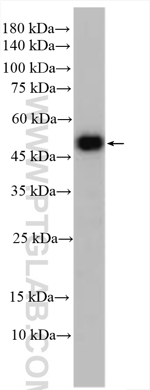 Western Blot (WB) analysis of various lysates using DFNA5/GSDME Polyclonal antibody (31363-1-AP)