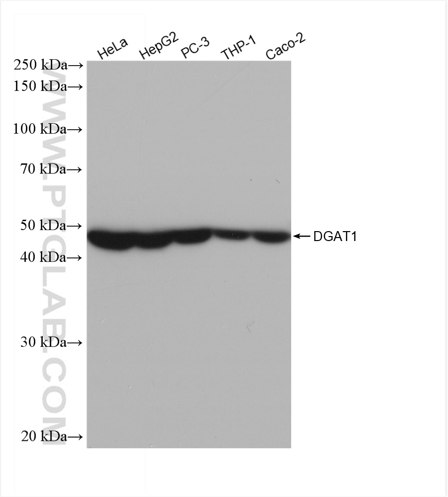 Western Blot (WB) analysis of various lysates using DGAT1 Recombinant antibody (82945-1-RR)