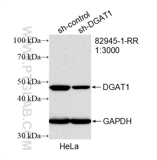 Western Blot (WB) analysis of HeLa cells using DGAT1 Recombinant antibody (82945-1-RR)