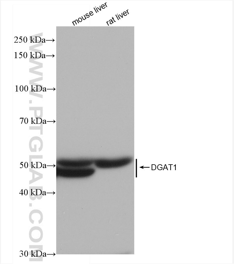 Western Blot (WB) analysis of various lysates using DGAT1 Recombinant antibody (82945-1-RR)