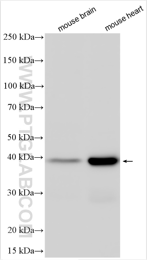 Western Blot (WB) analysis of various lysates using DGAT2 Polyclonal antibody (17100-1-AP)