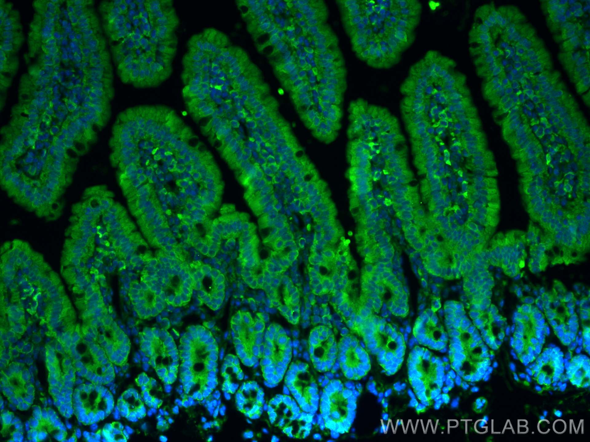 Immunofluorescence (IF) / fluorescent staining of mouse small intestine tissue using DGKQ Polyclonal antibody (17885-1-AP)